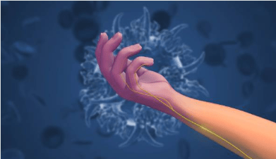 neuropatia-cubital-fisioterapia-rozas